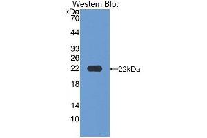 Detection of Recombinant MFAP2, Human using Polyclonal Antibody to Microfibrillar Associated Protein 2 (MFAP2) (MFAP2 antibody  (AA 6-162))