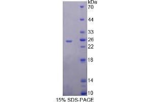 Image no. 1 for Ribonuclease, RNase A Family, 9 (Non-Active) (RNASE9) (AA 28-210) protein (His tag) (ABIN4991084)