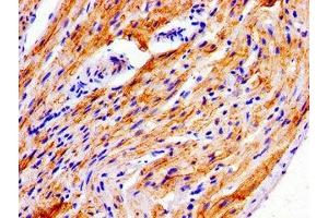 Immunohistochemistry of paraffin-embedded human heart tissue using ABIN7165855 at dilution of 1:100 (NDRG4 antibody  (AA 210-331))