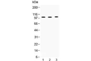 Western blot testing of 1) rat testis, 2) mouse testis and 3) MCF7 lysate with ADAM2 antibody at 0.