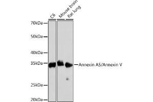 Western blot analysis of extracts of various cell lines, using Annexin /Annexin /Annexin V Rabbit mAb (ABIN7265623) at 1:1000 dilution. (Annexin V antibody)