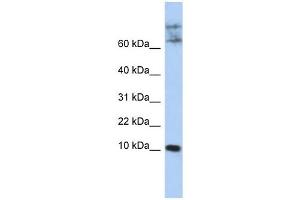 CKLF antibody used at 1 ug/ml to detect target protein.