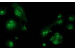 Anti-CDCP1 mouse monoclonal antibody (ABIN2454046) immunofluorescent staining of COS7 cells transiently transfected by pCMV6-ENTRY CDCP1 (RC220633). (CDCP1 antibody)