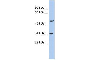 WB Suggested Anti-DBT Antibody Titration: 0. (DBT antibody  (N-Term))