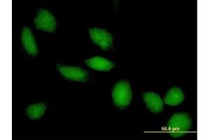 Immunofluorescence of purified MaxPab antibody to HDAC8 on HeLa cell. (HDAC8 antibody  (AA 1-377))