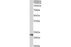 ABIN2561725 (0. (CD3G antibody  (Internal Region))