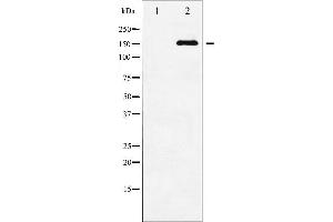 Western blot analysis of ASK1 phosphorylation expression in TNF-α treated MDA-MB-435 whole cell lysates,The lane on the left is treated with the antigen-specific peptide. (ASK1 antibody  (pSer83))