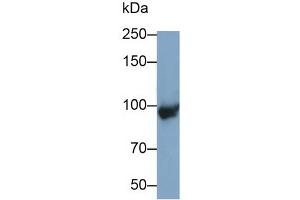 Detection of C4B in Mouse Placenta lysate using Polyclonal Antibody to Complement C4-B (C4B) (C4B antibody  (AA 126-366))