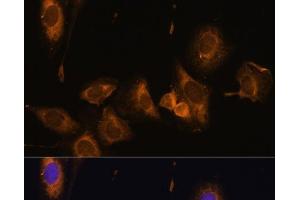 Immunofluorescence analysis of U-2 OS cells using RPL32 Polyclonal Antibody at dilution of 1:100 (40x lens).