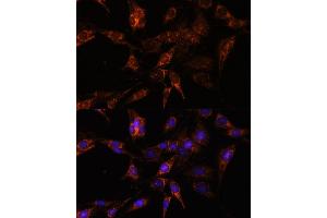 Immunofluorescence analysis of C6 cells using TBCC antibody (ABIN7271029) at dilution of 1:100. (TBCC antibody  (AA 1-346))