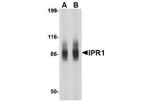 Image no. 1 for anti-SP110 Nuclear Body Protein (SP110) (N-Term) antibody (ABIN1494388) (SP110 antibody  (N-Term))