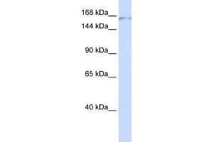 WB Suggested Anti-PDS5A Antibody Titration:  0. (PDS5A antibody  (C-Term))