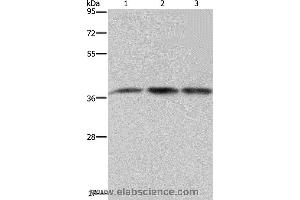 Western blot analysis of 293T and LoVo cell, human brain malignant glioma tissue, using CAB39 Polyclonal Antibody at dilution of 1:450