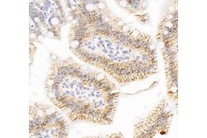 Immunohistochemistry of paraffin embedded mouse small intestine using ATP1A1 (ABIN7073154) at dilution of 1: 500 (400x lens) (ATPase (Na/K) antibody)