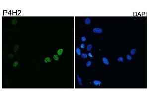 Diluted 1:10,000 on rhabdomyosarcoma cell line RD transfected with pCS2-DUX4. (DUX4 antibody  (C-Term))