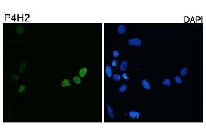 Diluted 1:10,000 on rhabdomyosarcoma cell line RD transfected with pCS2-DUX4.