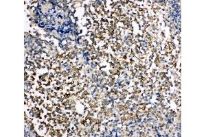 Anti-TIM 1 antibody, IHC(P) IHC(P): Human Tonsil Tissue (HAVCR1 antibody  (C-Term))