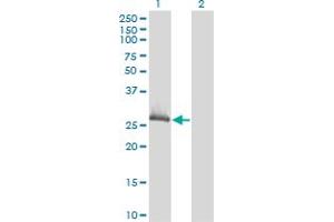 Western Blot analysis of CLIC1 expression in transfected 293T cell line by CLIC1 monoclonal antibody (M02), clone 3F9. (CLIC1 antibody  (AA 1-241))