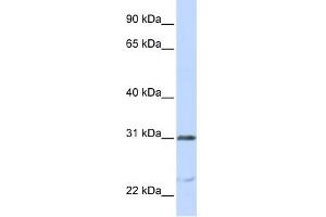 NUSAP1 antibody used at 1 ug/ml to detect target protein.