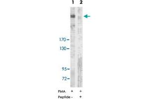 Western blot analysis of extracts from NIH/3T3 cells treated with PMA (125 ng/ml, 15 min), using ACACA polyclonal antibody . (Acetyl-CoA Carboxylase alpha antibody  (Ser80))
