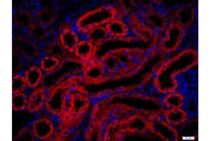 Paraformaldehyde-fixed, paraffin embedded rat kidney, Antigen retrieval by boiling in sodium citrate buffer (pH6. (PAK1 antibody  (AA 201-300))