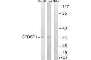 Western blot analysis of extracts from HUVEC cells and HeLa cells, using CTDSP1 antibody. (CTDSP1 antibody  (N-Term))