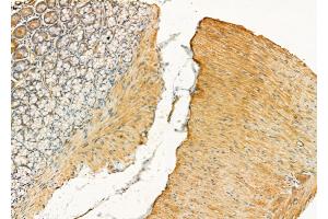 ABIN6258450 and ABIN6275840 at 1/100 staining Rat stomach tissue by IHC-P.