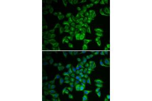 Immunofluorescence analysis of A549 cells using FXN antibody. (Frataxin antibody  (AA 42-210))