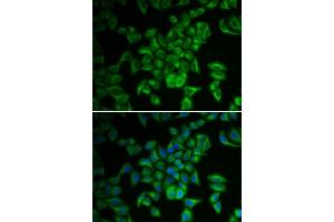 Immunofluorescence analysis of A549 cells using FXN antibody. (Frataxin antibody  (AA 42-210))