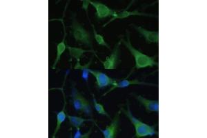 Immunofluorescence analysis of U-251 MG cells using F antibody (ABIN6129530, ABIN6140428, ABIN6140430 and ABIN6215290) at dilution of 1:100. (FABP7 antibody  (AA 1-132))