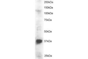 ABIN184695 staining (2µg/ml) of Jurkat lysate (RIPA buffer, 30µg total protein per lane). (PINX1 antibody  (N-Term))