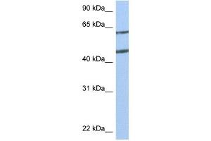 Netrin 4 antibody used at 1 ug/ml to detect target protein. (Netrin 4 antibody  (N-Term))