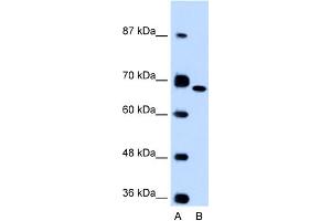 WB Suggested Anti-FN1 Antibody Titration:  0. (Fibronectin 1 antibody  (C-Term))