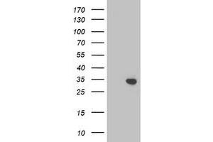 Western Blotting (WB) image for anti-Translocase of Outer Mitochondrial Membrane 34 (TOMM34) antibody (ABIN1501465)