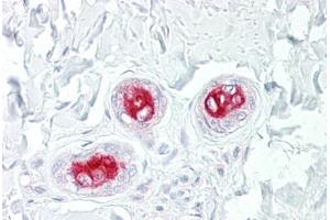 Anti-MAP3K5 / ASK1 antibody IHC staining of human skin, sweat ducts. (ASK1 antibody  (AA 49-98))