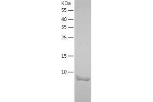 Western Blotting (WB) image for K(lysine) Acetyltransferase 2A (KAT2A) (AA 727-837) protein (His tag) (ABIN7123656) (KAT2A Protein (AA 727-837) (His tag))