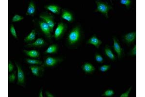 Immunofluorescence staining of A549 cells with ABIN7144036 at 1:266, counter-stained with DAPI.