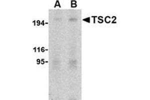 Western blot analysis of TSC2 in L1210 cell lysate with this product at (A) 2 and (B) 4 μg/ml.
