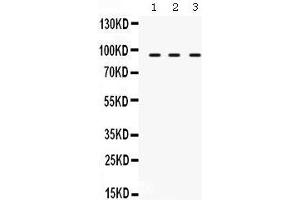 Western Blotting (WB) image for anti-Transporter 1, ATP-Binding Cassette, Sub-Family B (MDR/TAP) (TAP1) (AA 438-471), (Middle Region) antibody (ABIN3043943)