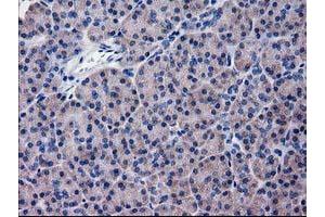 Immunohistochemical staining of paraffin-embedded Human pancreas tissue using anti-KATNAL1 mouse monoclonal antibody. (KATNAL1 antibody)