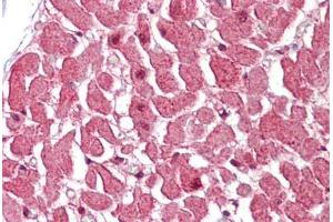 Human Heart (formalin-fixed, paraffin-embedded) stained with CASP12 antibody ABIN462331 followed by biotinylated goat anti-rabbit IgG secondary antibody ABIN481713, alkaline phosphatase-streptavidin and chromogen. (Caspase 12 antibody  (AA 100-116))