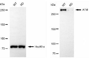 Western blotting analysis using ATM antibody (ABIN7797667). (Recombinant ATM antibody)