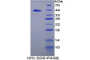 SDS-PAGE analysis of Mouse CNP Protein. (C-Type Natriuretic Peptide)