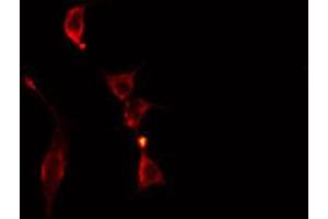 ABIN6273751 staining Hela cells by IF/ICC.
