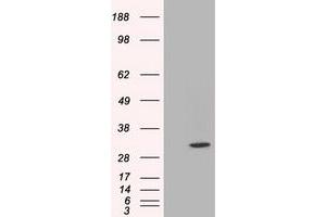 HEK293T cells were transfected with the pCMV6-ENTRY control (Left lane) or pCMV6-ENTRY C21orf59 (Right lane) cDNA for 48 hrs and lysed. (C21orf59 antibody)