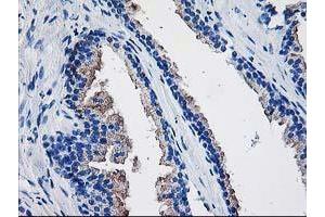 Immunohistochemical staining of paraffin-embedded Human prostate tissue using anti-TBC1D21 mouse monoclonal antibody. (TBC1D21 antibody)