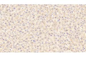Detection of ITIH4 in Rat Liver Tissue using Polyclonal Antibody to Inter Alpha-Globulin Inhibitor H4 (ITIH4) (ITIH4 antibody  (AA 478-722))