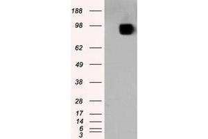 Western Blotting (WB) image for anti-Amyloid beta (A4) Precursor Protein (APP) antibody (ABIN1496878) (APP antibody)