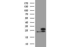Image no. 1 for anti-Ubiquitin-Conjugating Enzyme E2E 3 (UBE2E3) antibody (ABIN1501626) (UBE2E3 antibody)