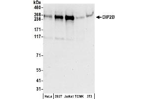 anti-DIP2 Disco-Interacting Protein 2 Homolog B (DIP2B) (AA 500-550) antibody